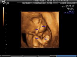 The Original Window to the Womb 4d baby scan 