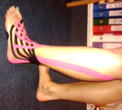 Kinesio Taping @ Body and Mind Studio