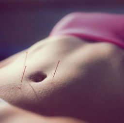 Fertility acupuncture