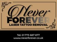 Never Forever Laser Tattoo Removal