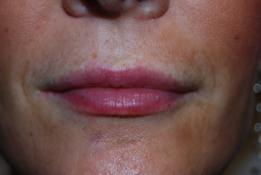 image0