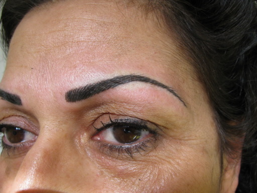 Picture of Hair Strokes Eyebrows after Procedure