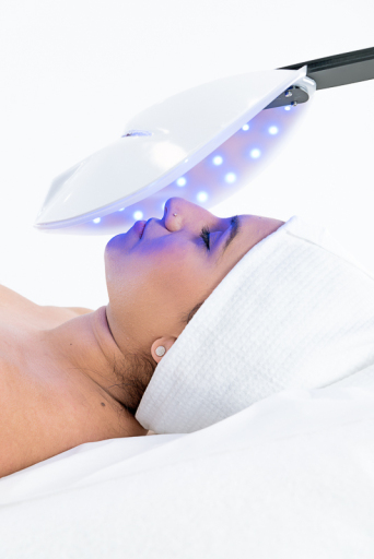 acne treatment wembley
