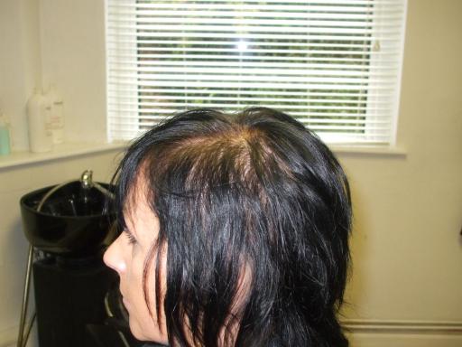 Before treatment