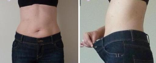 Weight loss