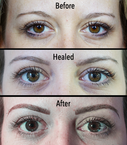 Microblading