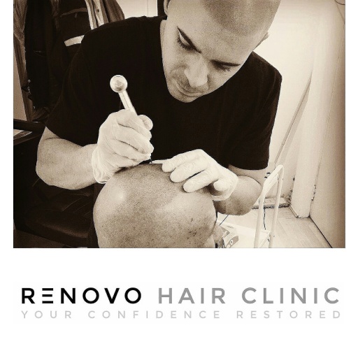 Performing scalp micropigmentation on a client