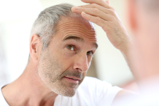 Hair Transplant London