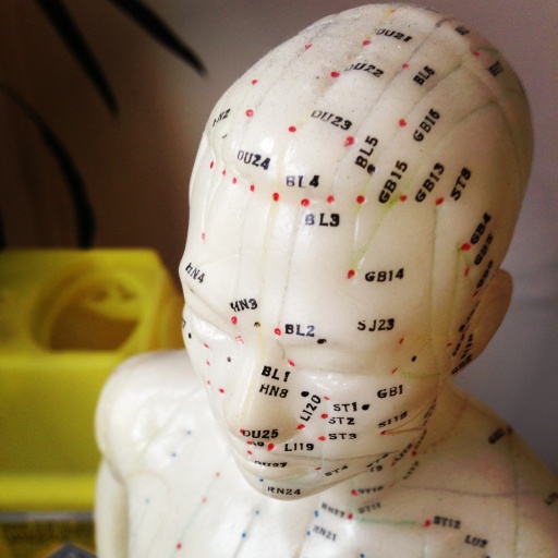 We do acupuncture