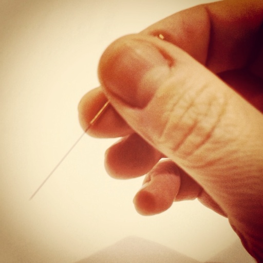 We do acupuncture