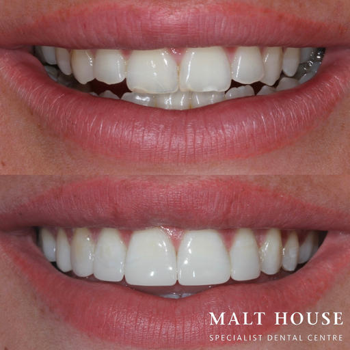 Malt House Specialist Dental Centre