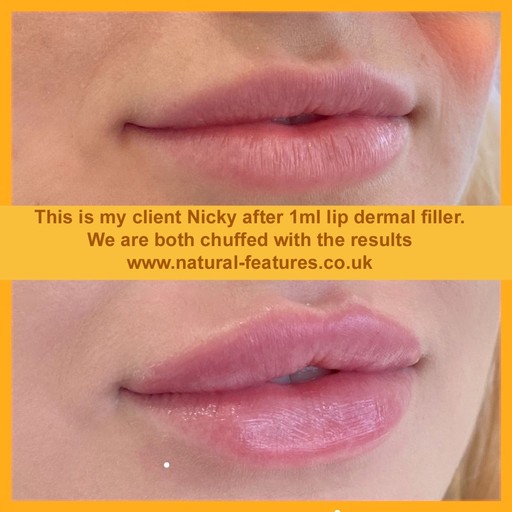 lips by Natural Features 