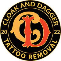 Cloak and Dagger Tattoo Removal