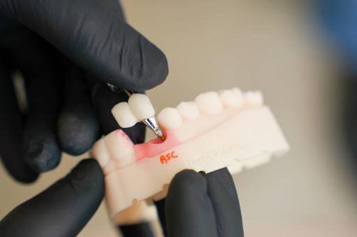 Emergency dentist Preston