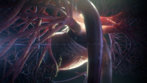 Angels & Demons 3D medical animation studio 5