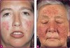 SKIN CARE{+27815844679}GA-RANKUWA,MMAKAU,SCHOEMANVILLE,MEDUNSA,DEWILDT,HEBRON,KGABALATSANE]TATTOO REMOVAL & WHITTENING PRODUCTS